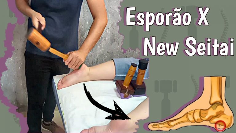 Esporão de calcâneo | Tratamento para esporão | Dor nos pés | dor no calcanhar | New Seitai