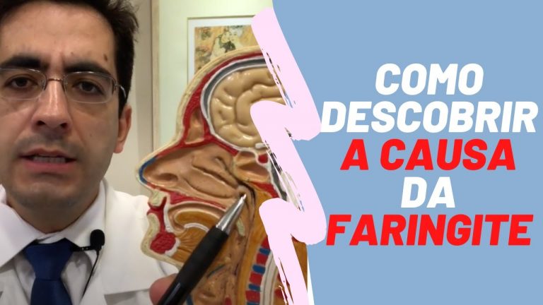 Por que  as pessoas tem FARINGITE? As principais causas!/ Dr. Paulo Mendes Jr – Otorrino em Curitiba