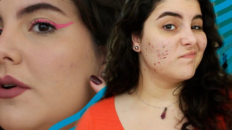 DICAS em um tutorial FÁCIL de maquiagem em pele com acne