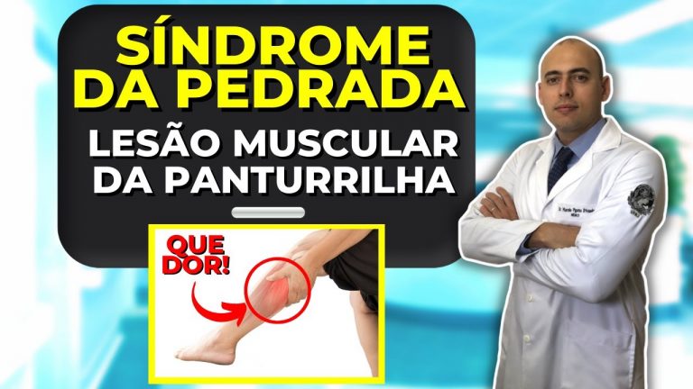 SÍNDROME DA PEDRADA | DISTENSÃO MUSCULAR DA PANTURILHA | O QUE É? QUAL O TRATAMENTO?