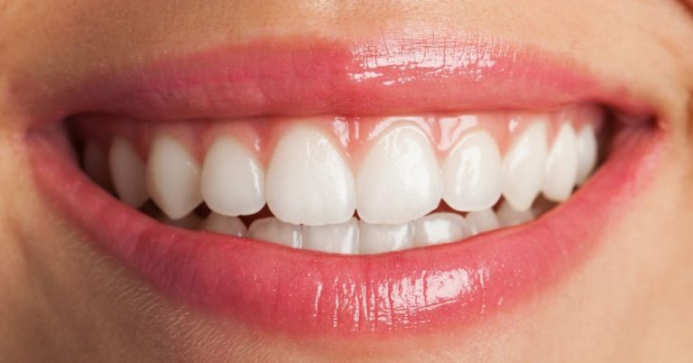 Como evitar manchas nos dentes após o clareamento? Veja 6 dicas
