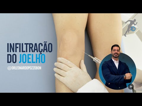 Infiltração do joelho | Dr. Leonardo Pozzobon