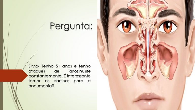 Tenho ataque de Rinosinusite constantemente | Vacina pneumonia como prevenção e tratamento.