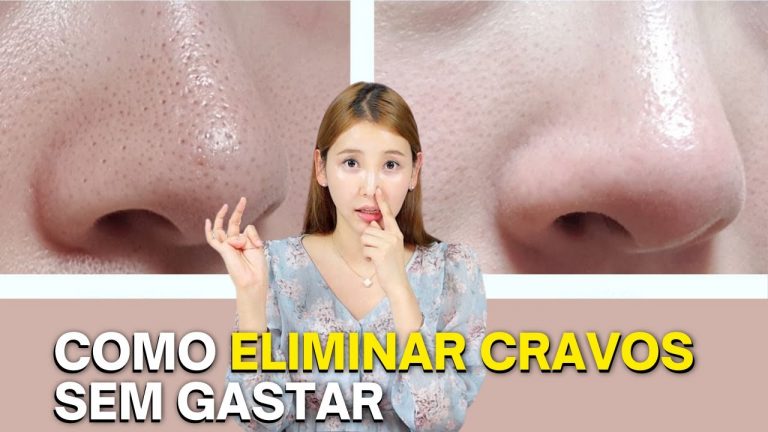 HOW TO ELIMINATE BLACKHEADS IN 1 WEEK