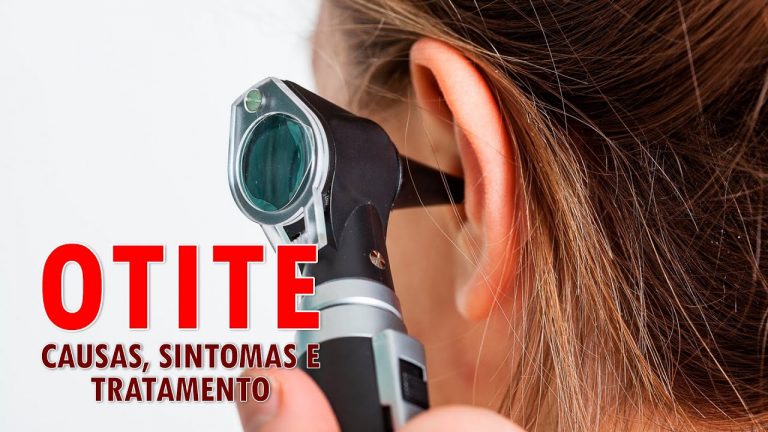 Otite – causas, sintomas e tratamento | Sua Saúde na Rede