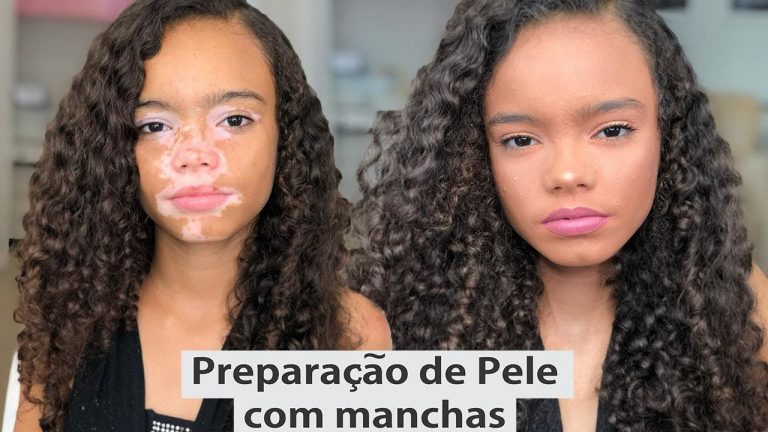 Como esconder manchas na pele de VITILIGO por Priscila Barbosa